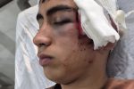 ورود دادستانی بم به پرونده تنبیه بدنی دانشآموز در دهبکری